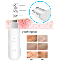 Imported™ Ultrasonic 5-in-1 Facial Scrubber